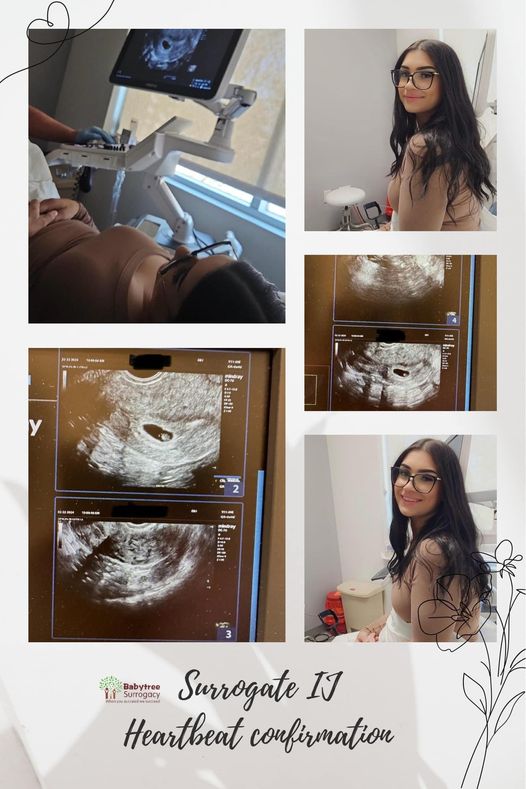 surrogate ij received heartbeat confirmation