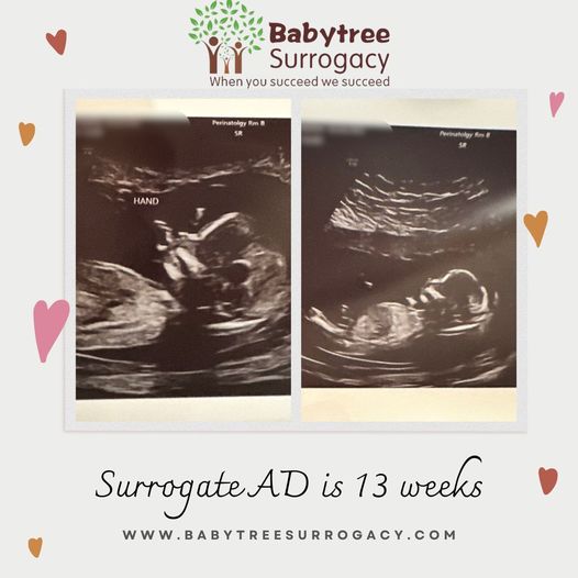 our amazing surrogate ad had her week appointment and ultrasound today, weeks